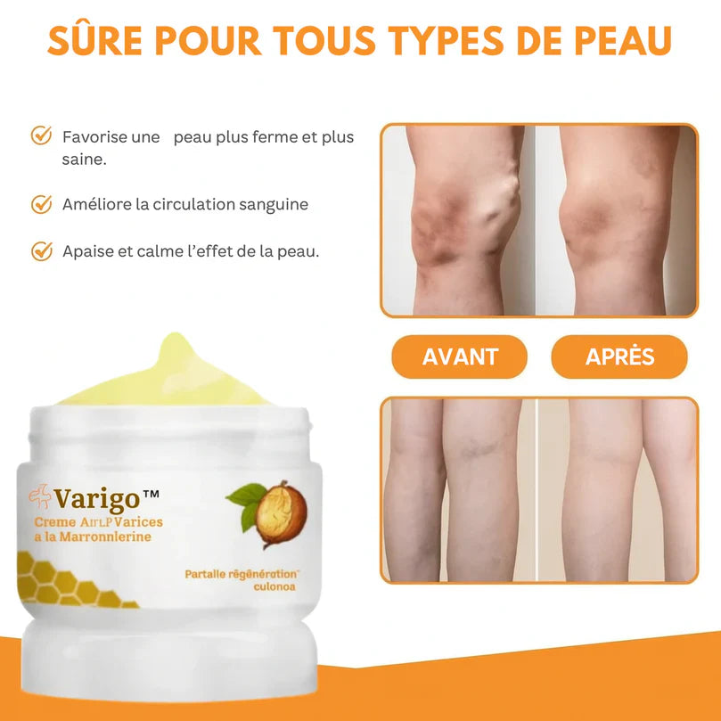 Varigo™ Crème Anti-Varices à la Marronnierine | Fait disparaître les varices dès la 1ère application!